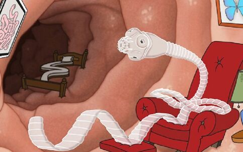 A parasite in the intestine settled down