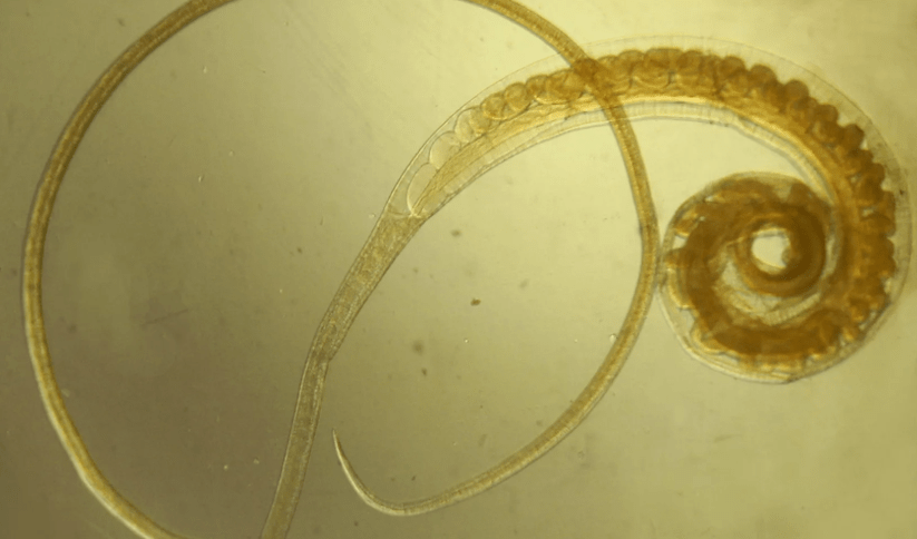 Trichocephalose from Vlasov