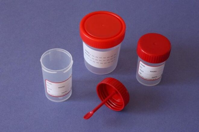 Parasit diagnostic methods in humans