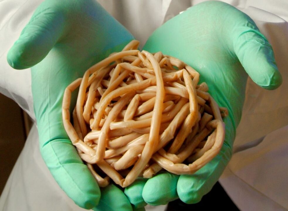 People have what parasites have